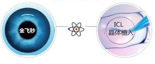 全飛秒和晶體植入