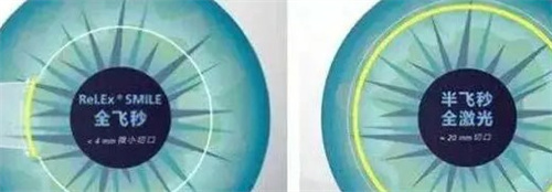 全飛秒和半飛秒 全飛秒和半飛秒