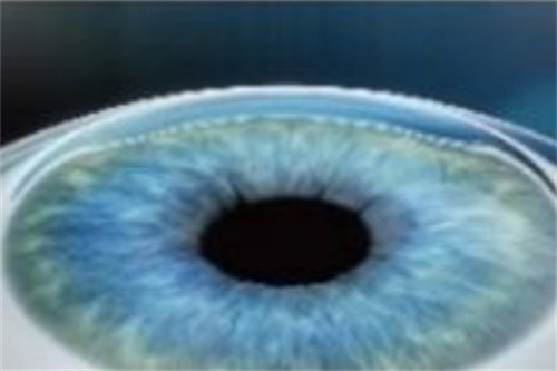 全飛秒手術(shù)結(jié)束