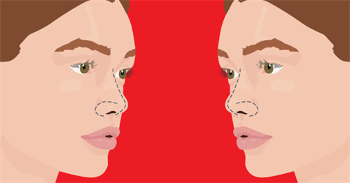 鼻部形態(tài)示意圖 鼻部形態(tài)示意圖