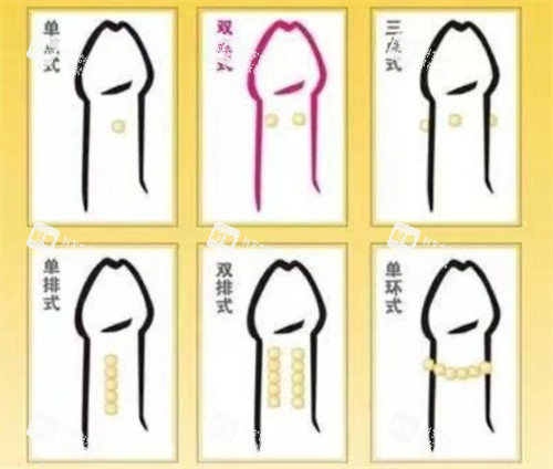 陰莖入珠術(shù)款式