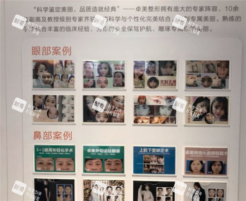 武漢硚口卓美整形展示墻