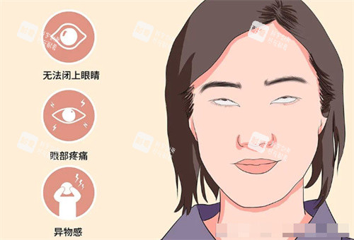 需要做眼修復(fù)的情況