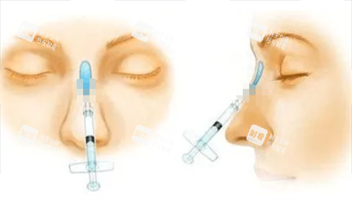 玻尿酸注射隆鼻動畫展示圖