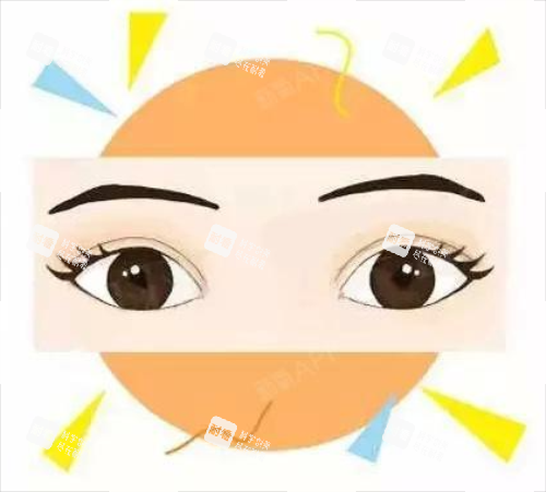全切雙眼皮效果圖