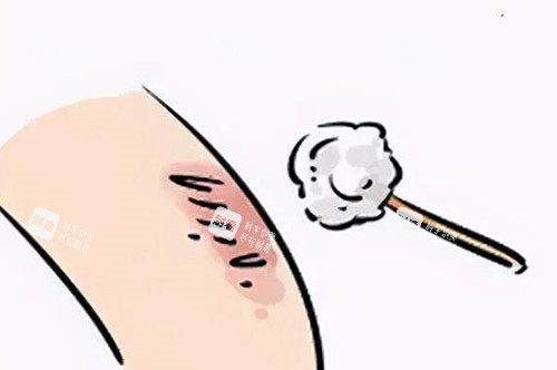 疤痕改善祛除卡通圖