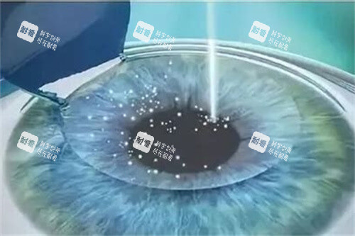 北京普瑞華德眼科預(yù)約掛號(hào)超簡(jiǎn)單！線上快速對(duì)接，不耽誤看眼