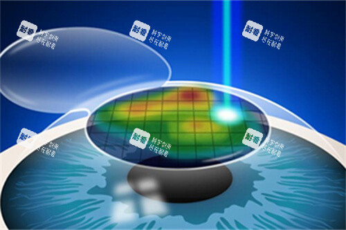 近視手術(shù)漫畫示意圖 近視手術(shù)漫畫示意圖