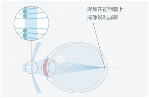 依視路星趣控鏡片的優(yōu)勢圖解