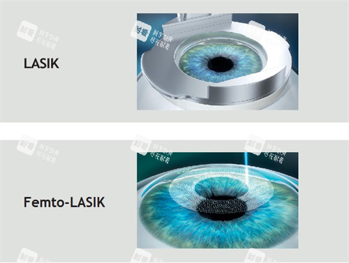 全飛秒和半飛秒對比