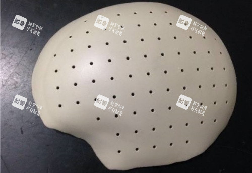 PEEK材料填充顱骨示意圖