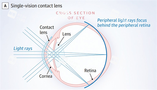 離焦鏡成像原理