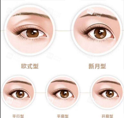 雙眼皮類(lèi)型圖示