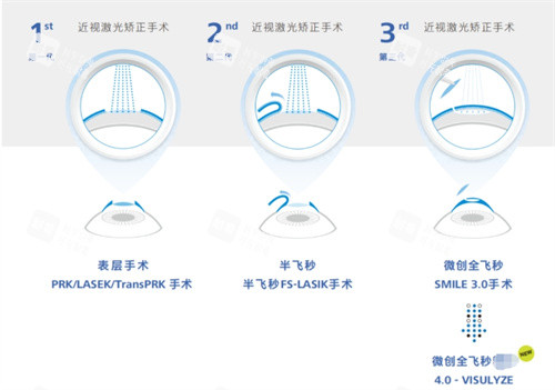 全飛秒4.0技術(shù)與其他技術(shù)對比