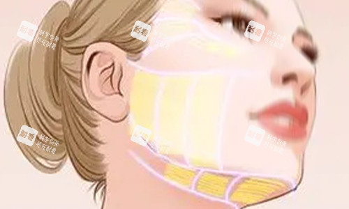 拉皮手術(shù)范圍示意圖 拉皮手術(shù)范圍示意圖