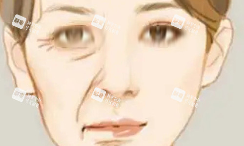 拉皮手術(shù)的對(duì)比動(dòng)畫圖 拉皮手術(shù)的對(duì)比動(dòng)畫圖