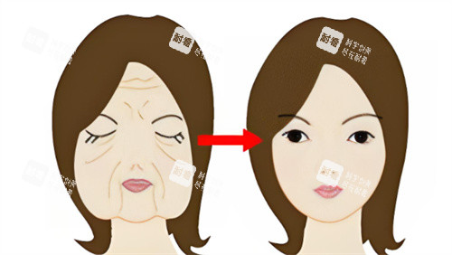 面部抗衰前后對比 面部抗衰前后對比