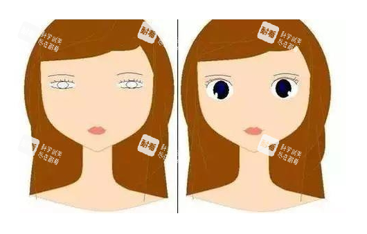 眼皮松弛做雙眼皮對(duì)比圖
