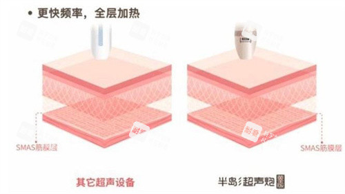 半島超聲炮和普通超聲