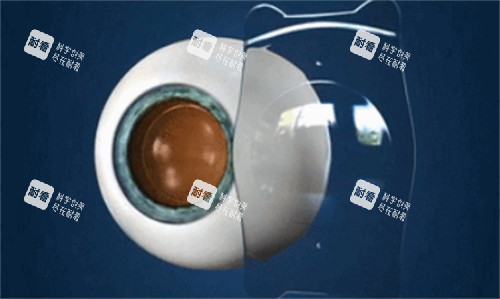 人工晶體的樣子