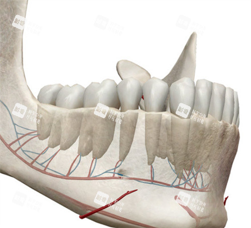 正頜手術(shù)模型