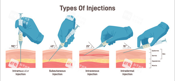 陰道緊縮針進針角度