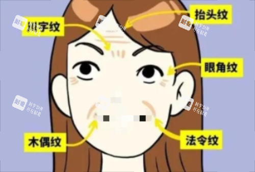 面部皺紋詳細示意圖
