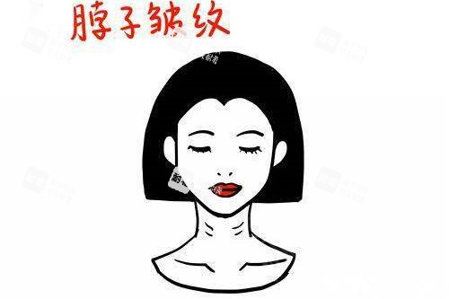 脖子皺紋卡通圖