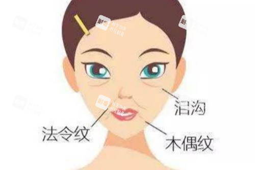 臉上皺紋卡通圖片