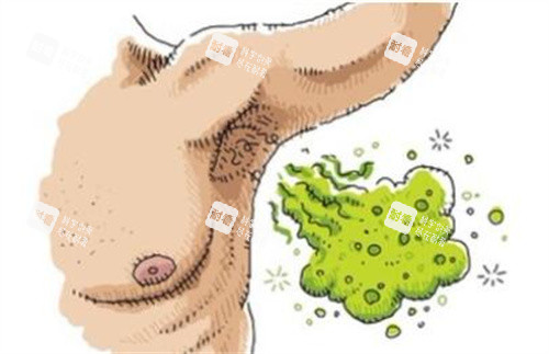 腋臭卡通圖照片圖