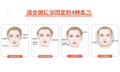 面部輪廓固定適合類型