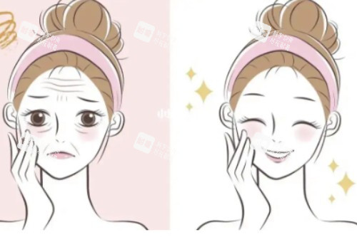 面部狀態(tài)提升對(duì)比圖