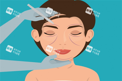 面部提升卡通圖