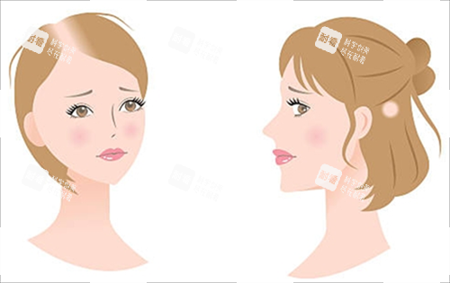 各種脫發(fā)素材