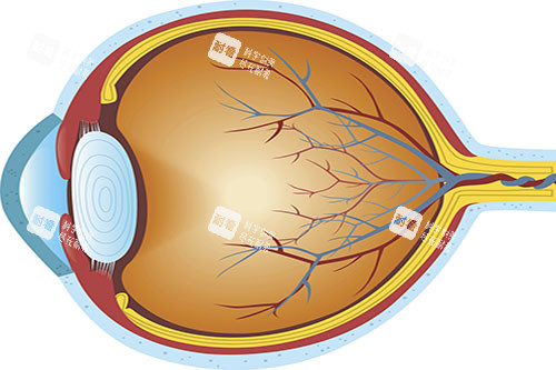視網(wǎng)膜色素變性眼部狀況圖 視網(wǎng)膜色素變性眼部狀況圖