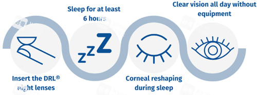角膜塑形鏡過程