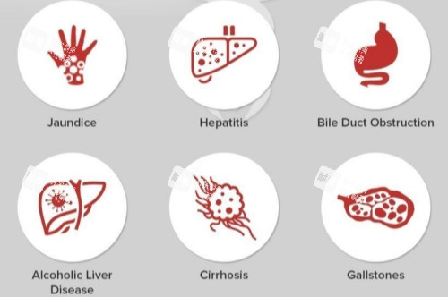 眼睛發(fā)黃原因 眼睛發(fā)黃原因