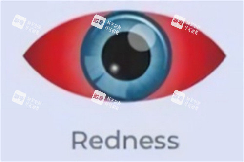干眼癥眼睛紅腫