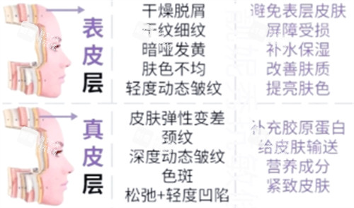 不同皮膚層次抗衰重點 不同皮膚層次抗衰重點