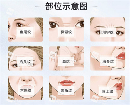 面部除皺部位演示動畫圖