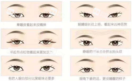 不同可以進(jìn)行雙眼皮的眼睛