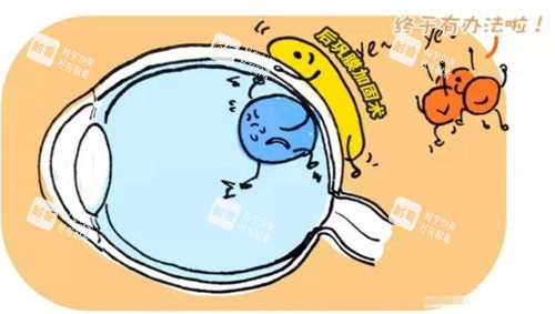 后鞏膜加固術(shù)圖片 后鞏膜加固術(shù)圖片