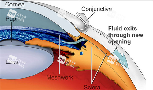 青光眼出現(xiàn)問(wèn)題的部位