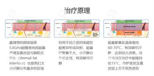 清新微波去腋臭技術原理圖解