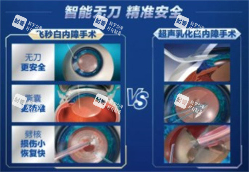 愛爾眼科白內(nèi)障手術(shù)