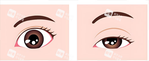 眼睛形態(tài) 眼睛形態(tài)