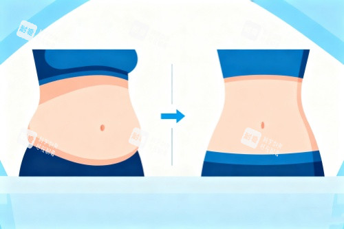 腰腹部做吸脂卡通圖 腰腹部做吸脂卡通圖