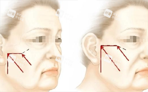 成都素美醫(yī)療美容超正規(guī)！衛(wèi)健委備案+診療透明，醫(yī)美項(xiàng)目放心選