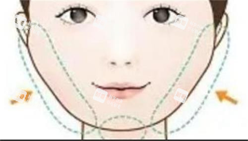 磨骨手術的部位 磨骨手術的部位