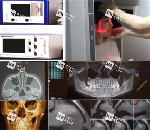 杭州連天美整形高俊明磨骨術前檢查 杭州連天美整形高俊明磨骨術前檢查